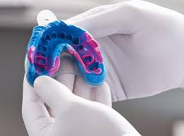 procédure implant dentaire