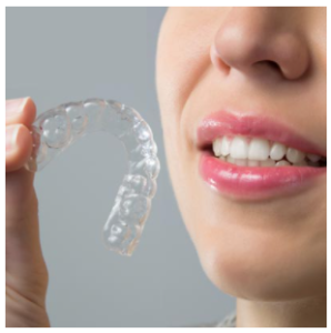 invisalign photo lyon