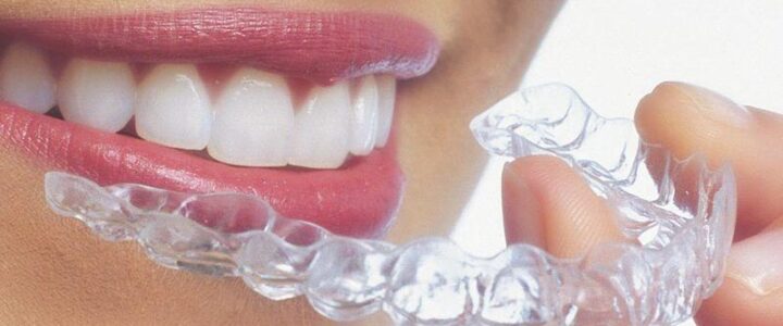 contre indication invisalign