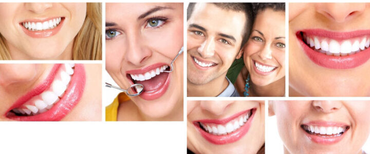 Soins d’hygiène dentaire esthétiques : facettes et couronnes dentaires