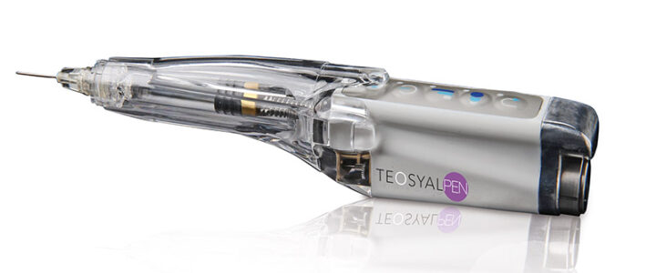 Teosyal Pen : nouvel instrument de comblement