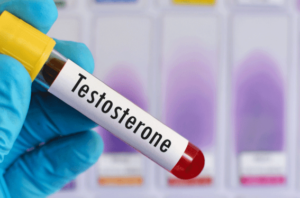 testosterone