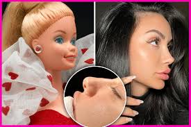 « Barbie Nose » : la nouvelle tendance en rhinoplastie