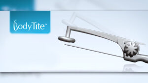 bodytite