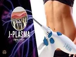 j-plasma