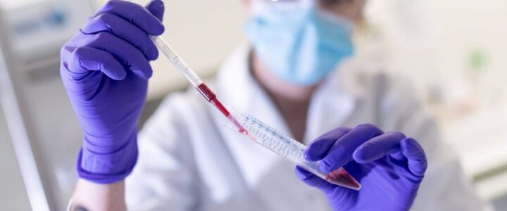 cicatrisation grands brulés