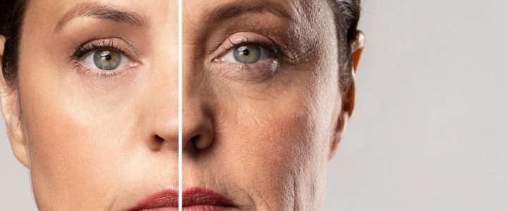 Ozempic Face : pourquoi le visage change après une perte de poids rapide ? ozempic face