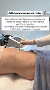 solutions pour raffermir la peau relâchée