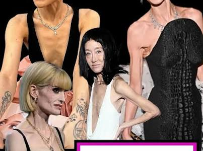 Stars américaines et Ozempic : quand la perte de poids transforme la silhouette stars américaines et ozempic